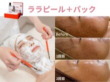 プラスボーテ 幡ヶ谷(plus beaute)/ララピール（顔＋首）