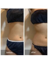 コマ(KOMA)/究極のくびれ！