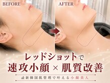 エンズ 米野木店(0's)