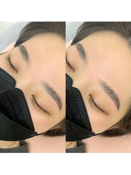 ラ フルール(La Fleur)/ハリウッドブロウリフト