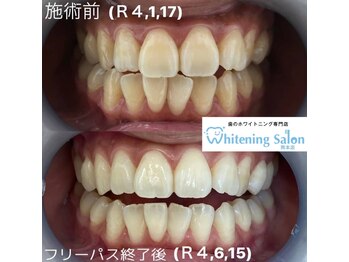 ホワイトニングサロン 熊本店/通い放題のホワイトニング