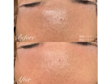 各種オプション取り揃えております