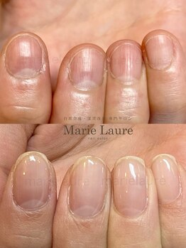 マリーロール 淀屋橋本店(Marie Laure)/自爪育成/深爪矯正/ネイルケア