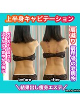 ビューティ ウィッチ(Beauty Witch)/