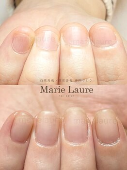 マリーロール 淀屋橋本店(Marie Laure)/自爪育成/深爪矯正/ネイルケア
