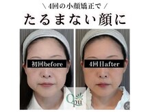 キュープ 奈良店(Qpu)/