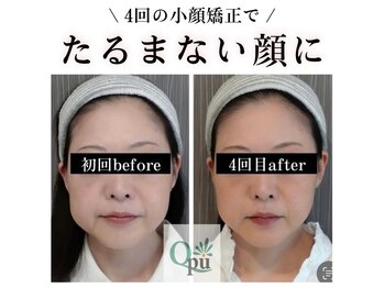 キュープ 奈良店(Qpu)/