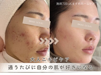 ビカオ(BIKAO)の写真