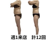 全身痩身エステ120分コース12回3ヶ月【出産経験あり50代】