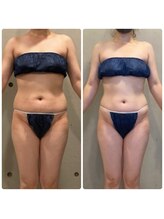 エクセレントビューティーサロン 艶(EN)/減量プログラム　ブライダル