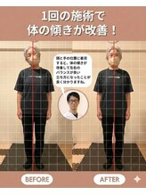 のなか整体院/整体 Before→After