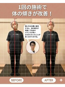 のなか整体院/整体 Before→After