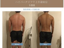 漢方アロマヒーリングサロン 浦和店(漢方AROMAヒーリングサロン)/ハイパーナイフ７上半身◆５回目