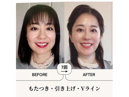 ふらっとエステの写真