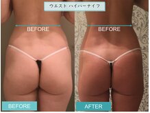 プライマルビューティ 艶 本店(Primal Beauty)/本気の痩身！ADEで痩せよう！