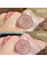 エクラ バイ シャンリィ(eclat by shanLy)/目で見えないところまで！