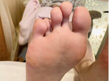 ビサンテ サロン/3D足裏アーチBalance調整で人気4