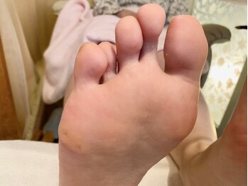 ビサンテ サロン/3D足裏アーチBalance調整で人気4