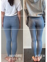 ホリック アイス コア ボディ(HOLIC ICE CORE BODY)/お客様ビフォーアフター2