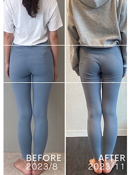 ホリック アイス コア ボディ(HOLIC ICE CORE BODY)/お客様ビフォーアフター2