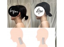 ミ ジュエル(me jewel)/首周りのお悩みを解消