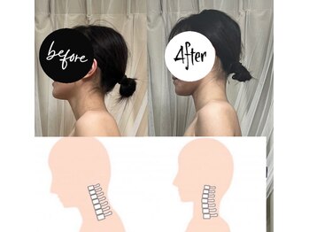 ミ ジュエル(me jewel)/首周りのお悩みを解消