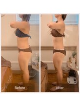 カルナ(carna)/《3か月計6回》2週間に1回