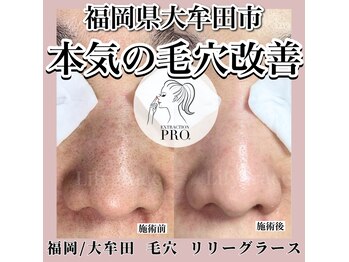 リリーグラース(Lilygrace)