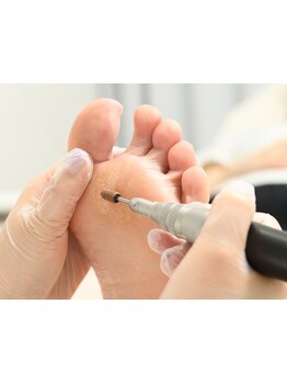 角質ケアができるサロン