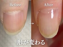 アーク(arc) PG014100056