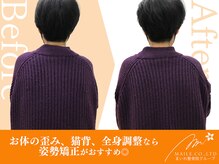 まいれ鍼灸整骨院 整体院 長浜院/姿勢矯正ビフォーアフター