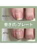 《プレート》【巻き爪矯正1本】透明で目立たず即効性も期待¥9800→¥6500