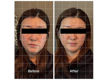 ロバスト(ROBUST)の写真