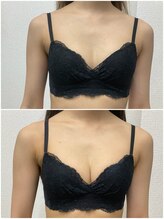 バーディー(BIRDIE)/施術１回/２０代