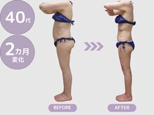 ビップ 赤坂店(Bipp!)/40代・2カ月の変化