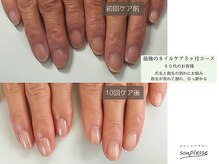 スプレースの雰囲気（お客様のネイル★しょっちゅう割れてしまう爪先と指先の変化です）
