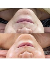 ビューティーツリー(Beauty Tree)/【老化しない肌へ！】