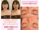 パピヨン(papillon)の写真