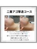9月限定【部分】二重アゴ撃退コース