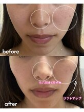 セルヴィノバ(CELL VI NOVA)/結果重視☆ツヤ肌