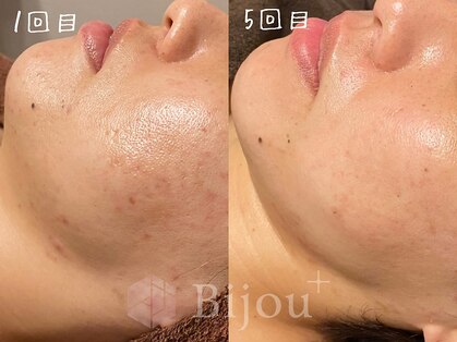 ビジュープラス 神栖店(Bijou+)の写真