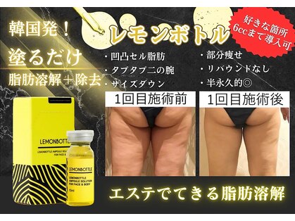 クリニカルエステ イーズ 小倉リバーウォーク北九州デコシティ店の写真