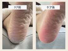 ルポ 伊勢/角質ケア