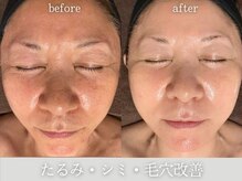 ディサイドロー(DECIDE L.A.W)