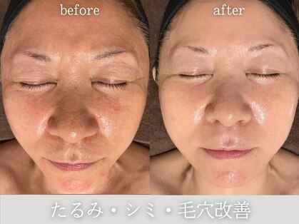 ディサイドロー(DECIDE L.A.W)の写真