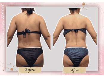 ヌーン(noon)/痩身・全身のむくみ解消