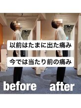 カワル整体 上通り院/慢性的な肩こり腰痛の症状の原因
