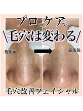 ルネッタ(Lunetta)/