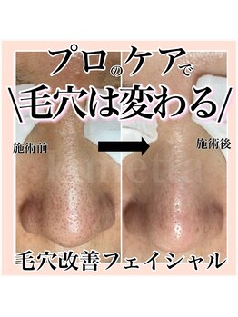 ルネッタ(Lunetta)/