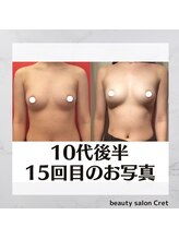 クレット 銀座店(Cret)/サイズアップ☆数ヶ月後